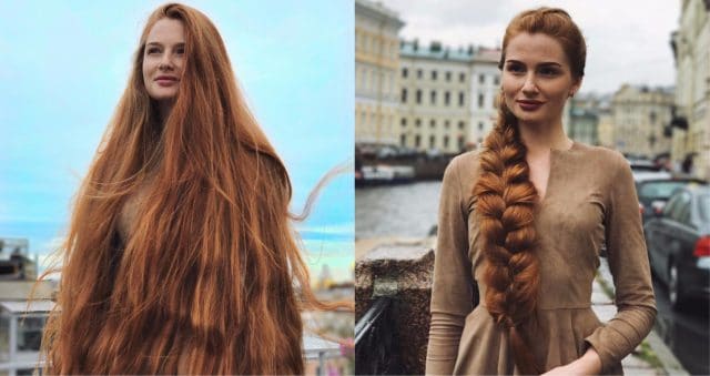 История московской Рапунцель! Девушка победила облысение и теперь помогает всем бороться с выпадением волос!