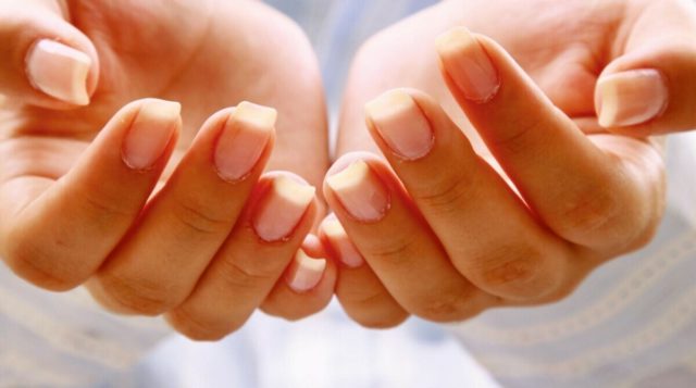 7 болезней, о которых сигнализирует состояние ваших рук