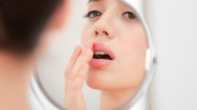 Простуда на губе: чем лечить герпес и из-за чего он возникает?